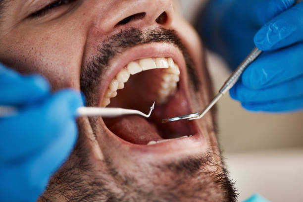 Best Tooth Pain Emergency Relief  in Matthews, NC