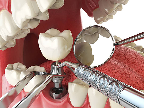 Best Dentist for Tooth Abscess  in Matthews, NC